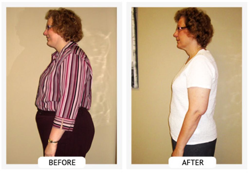 Before and After- Sherry lost 55 lbs and 41 inches.