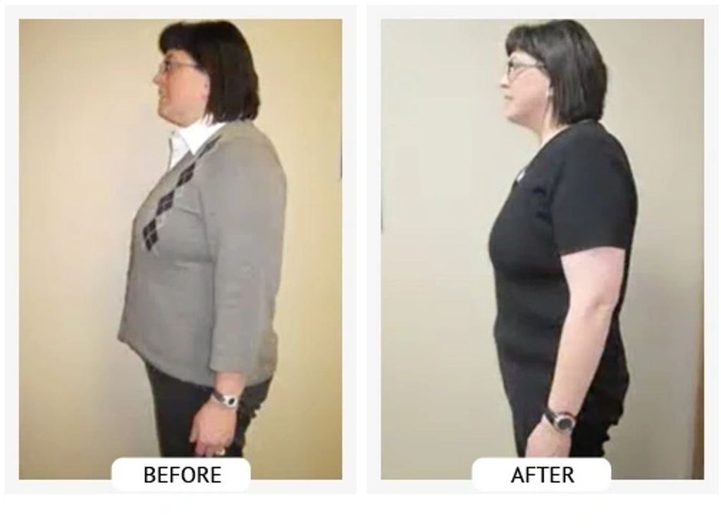 Before and After- Lisa lost 27 lbs and 20.5 inches in 6 weeks.
