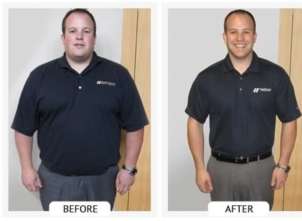 Before and After- Dr. Sneldon lost over 100 lbs in 100 days.