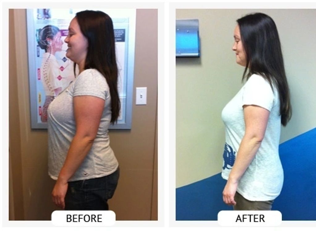 Before and After- Angelica lost 26 lbs and 24 inches in 42 days.