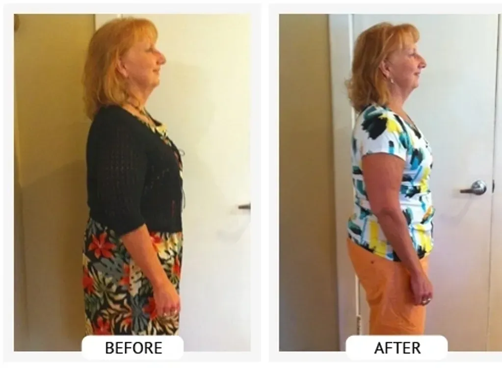 Before and After- Barb W. lost 27 lbs and 25 inches in 40 days.