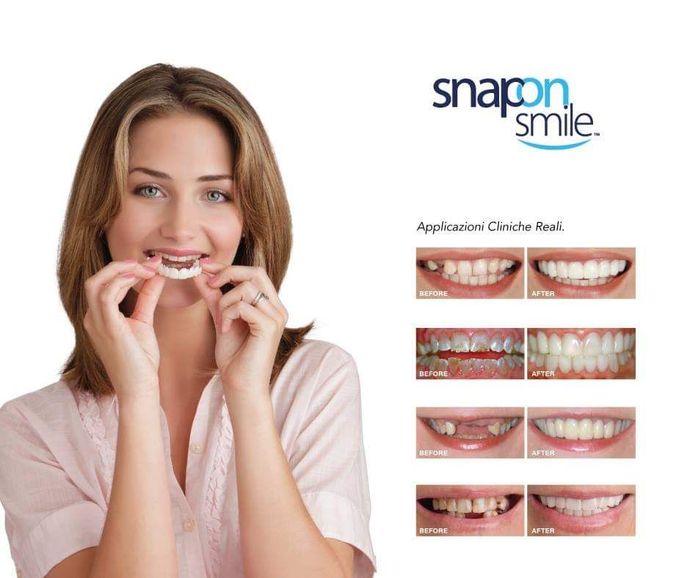 Snap-on ortondozia invisibile Catania