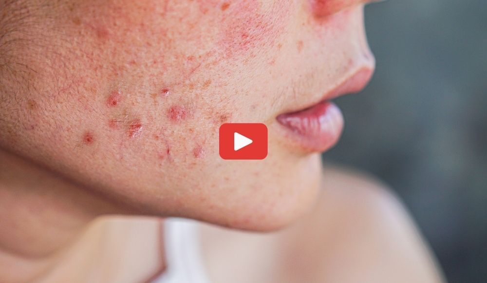 Skin Issues