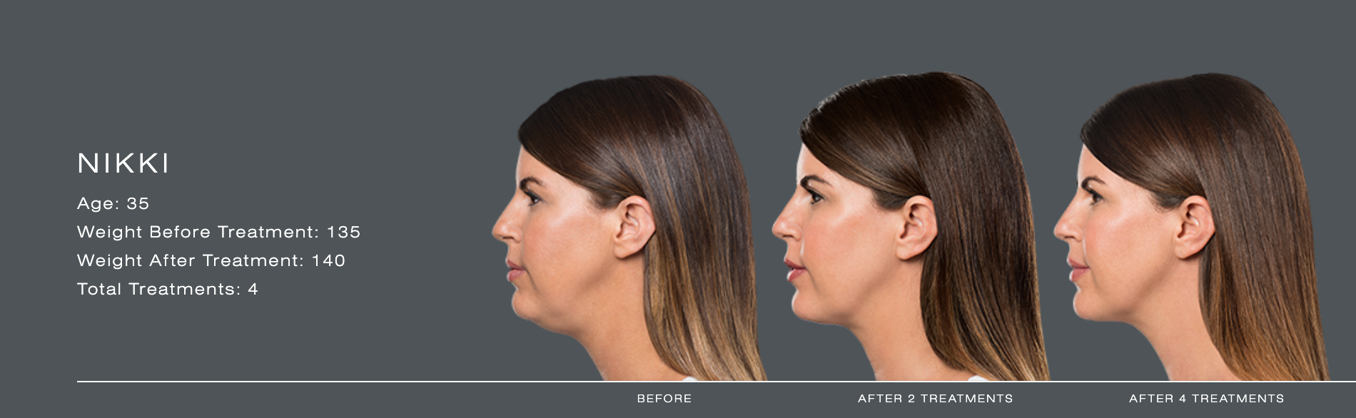 Side-profile comparison of a brunette woman with tied-back hair on a gray background, with text at left.