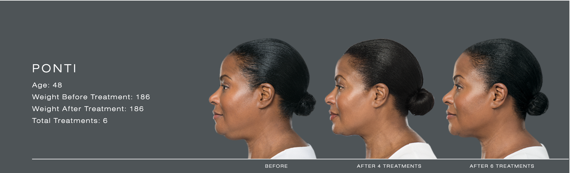 Three side-profile headshots of a woman on a dark background, showing slight changes in jaw and neck posture.