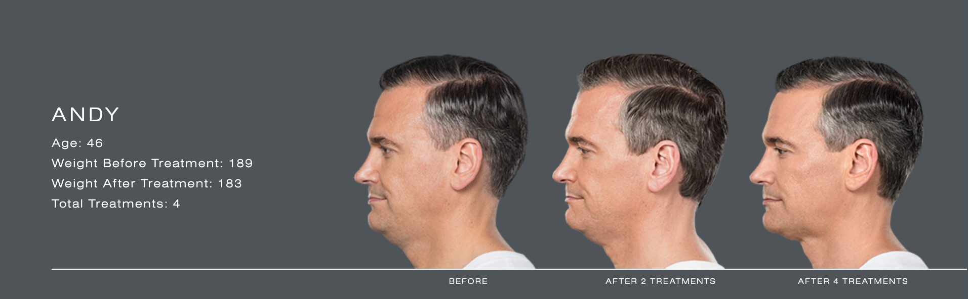 Three side-profile views of a man with short dark hair against a gray background, showing a hairstyle comparison.