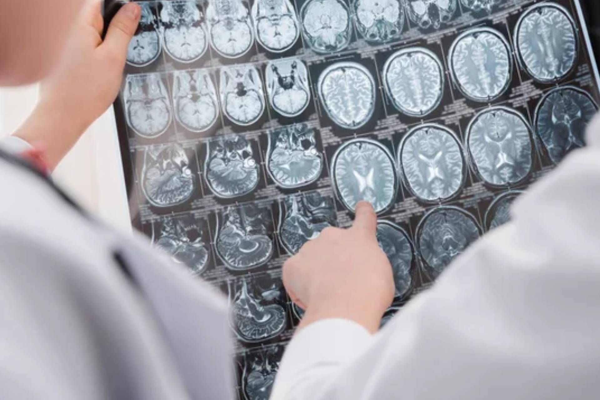La paura di volare provoca sintomi simili all'epilessia La paura di volare provoca sintomi simili all'epilessia