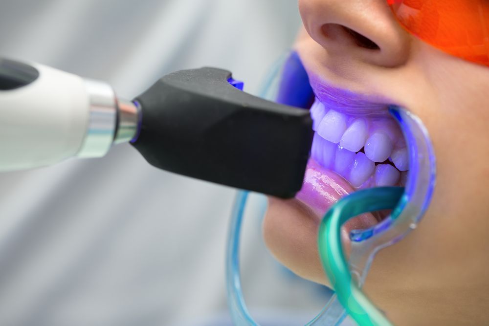 A Man Is Getting His Teeth Whitened By A Dentist — Barry Bennett Dental In Earlville, QLD