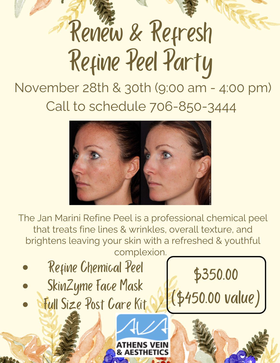 Renew & Refresh Refine Peel Party