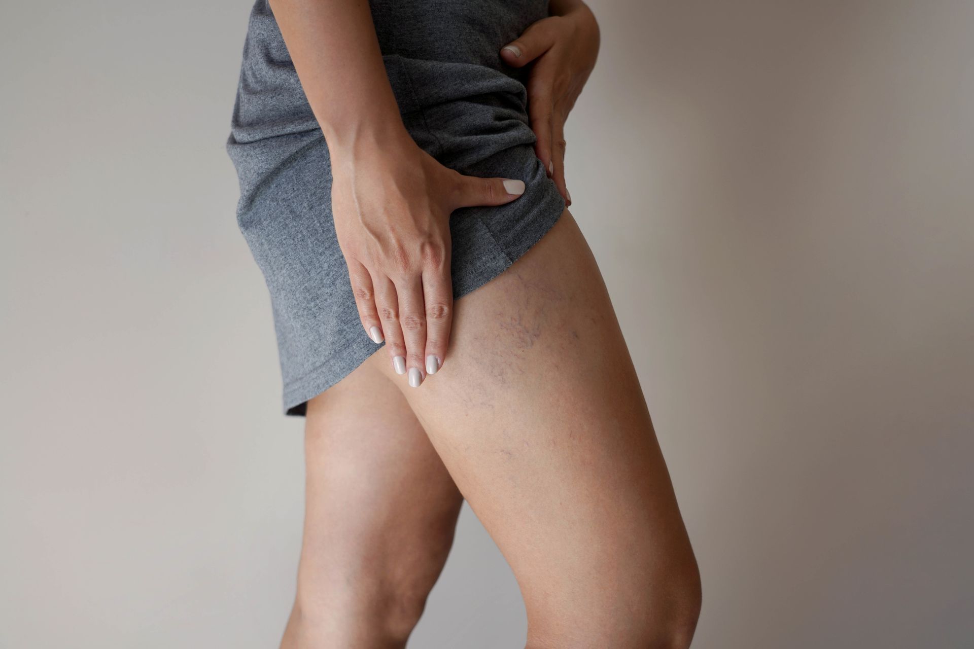 A woman is holding her leg in pain.