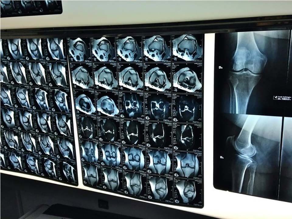radiografie