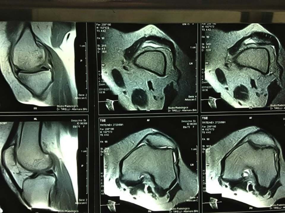 RISONANZA MAGNETICA