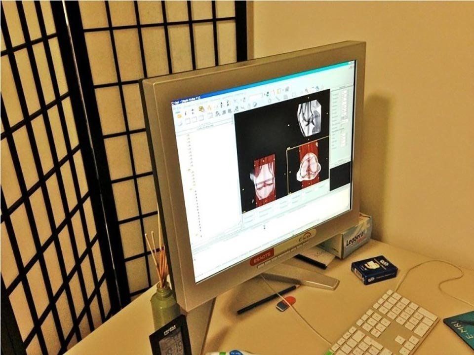 radiografie al pc