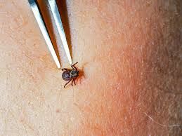 Ticks Pest Control Metro Oklahoma City, OK