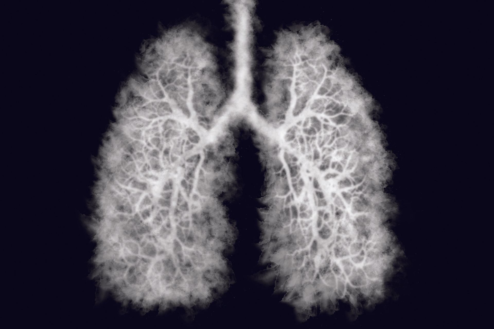 Smoke Filled Lungs