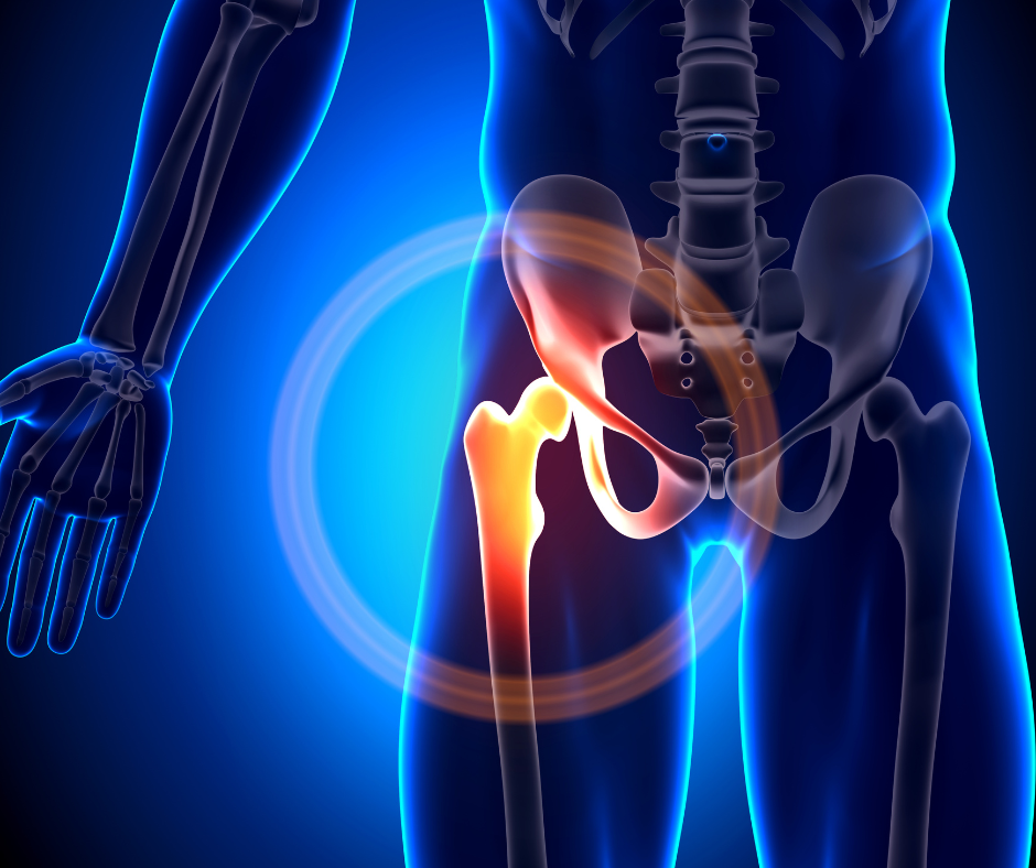Hip Surgery