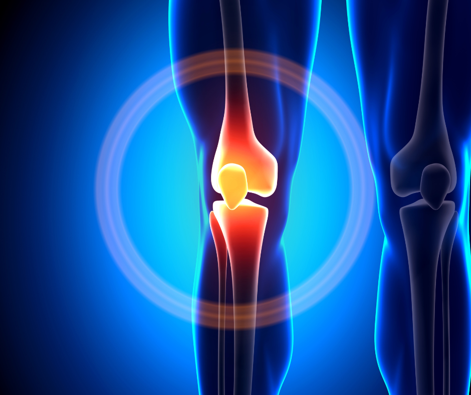 Knee Surgery