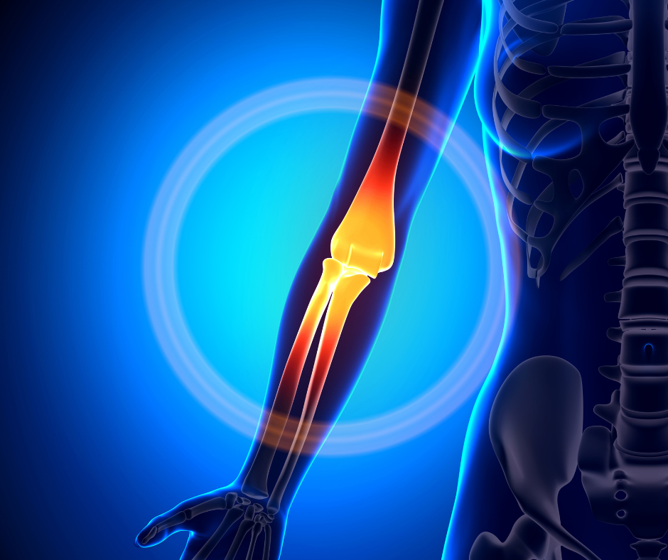 Elbow Surgery