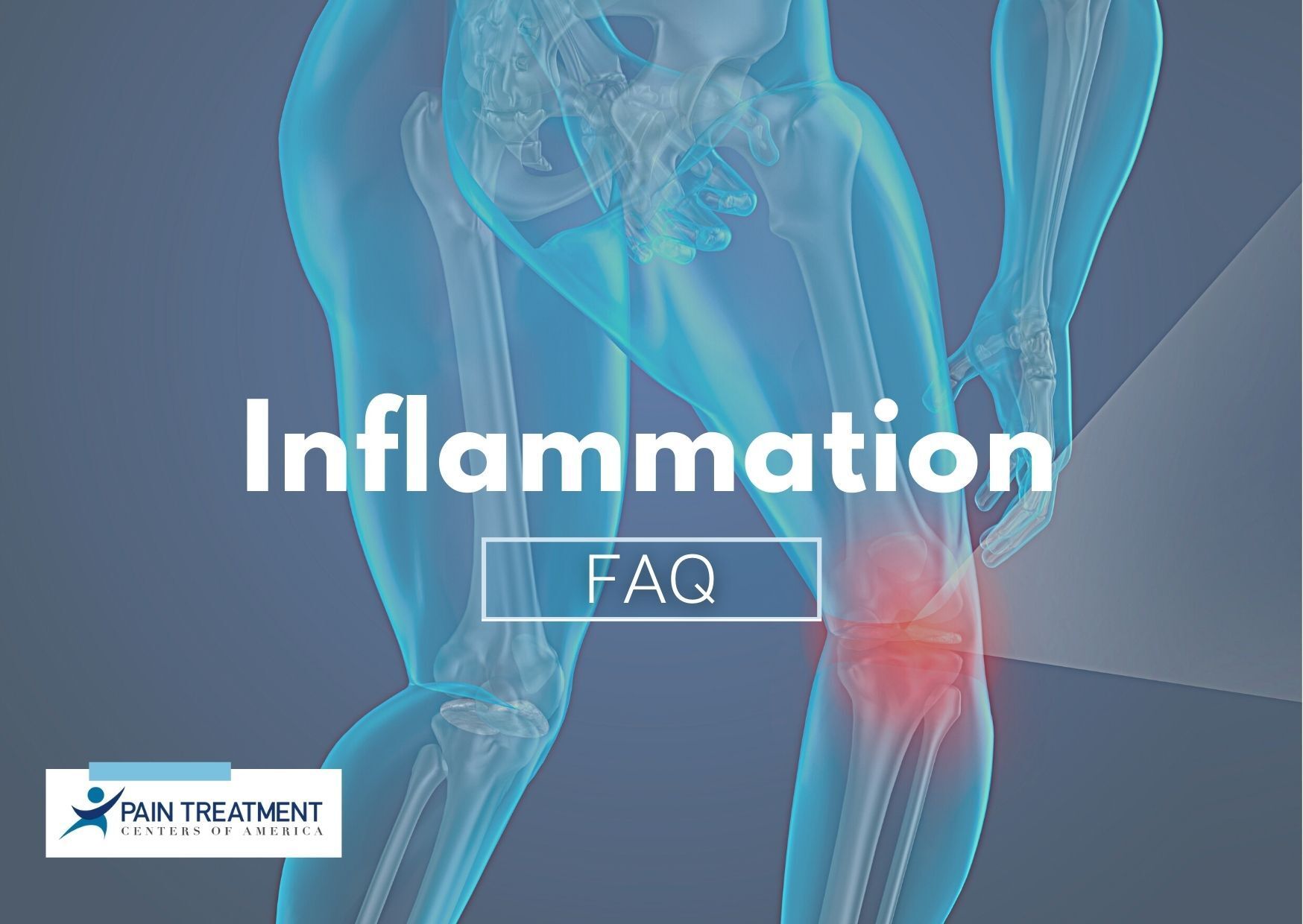 diagram of inflamed knee