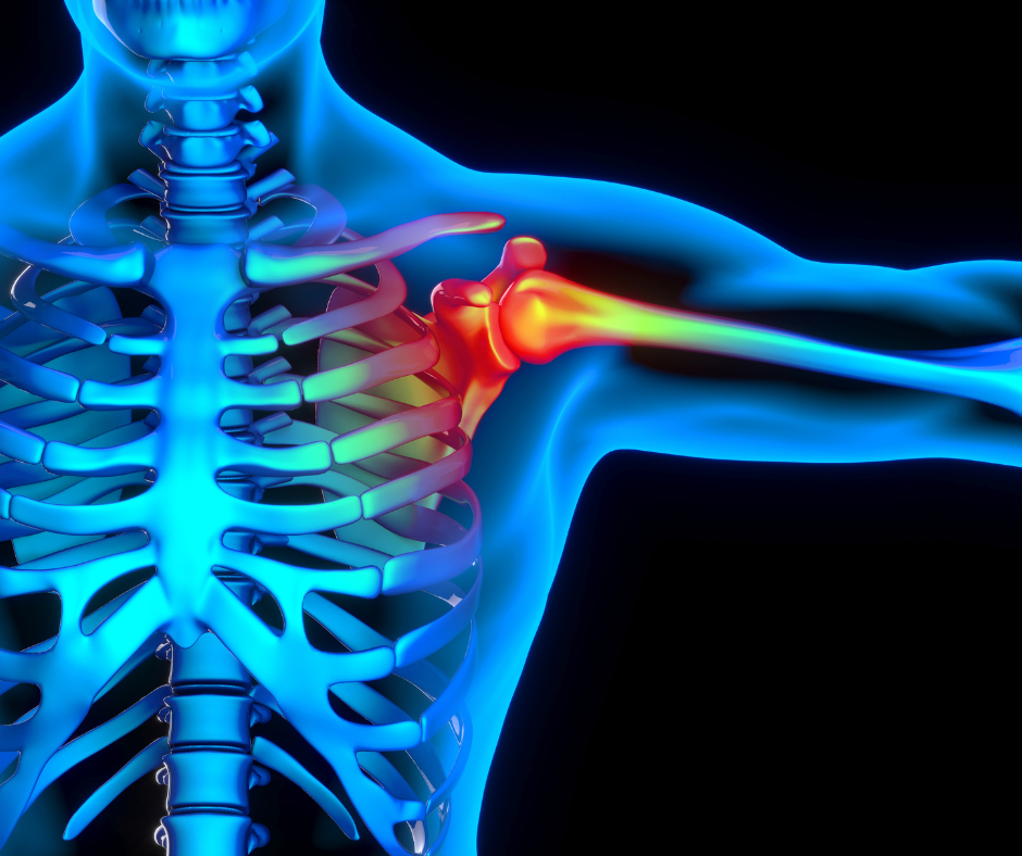 Shoulder Surgery