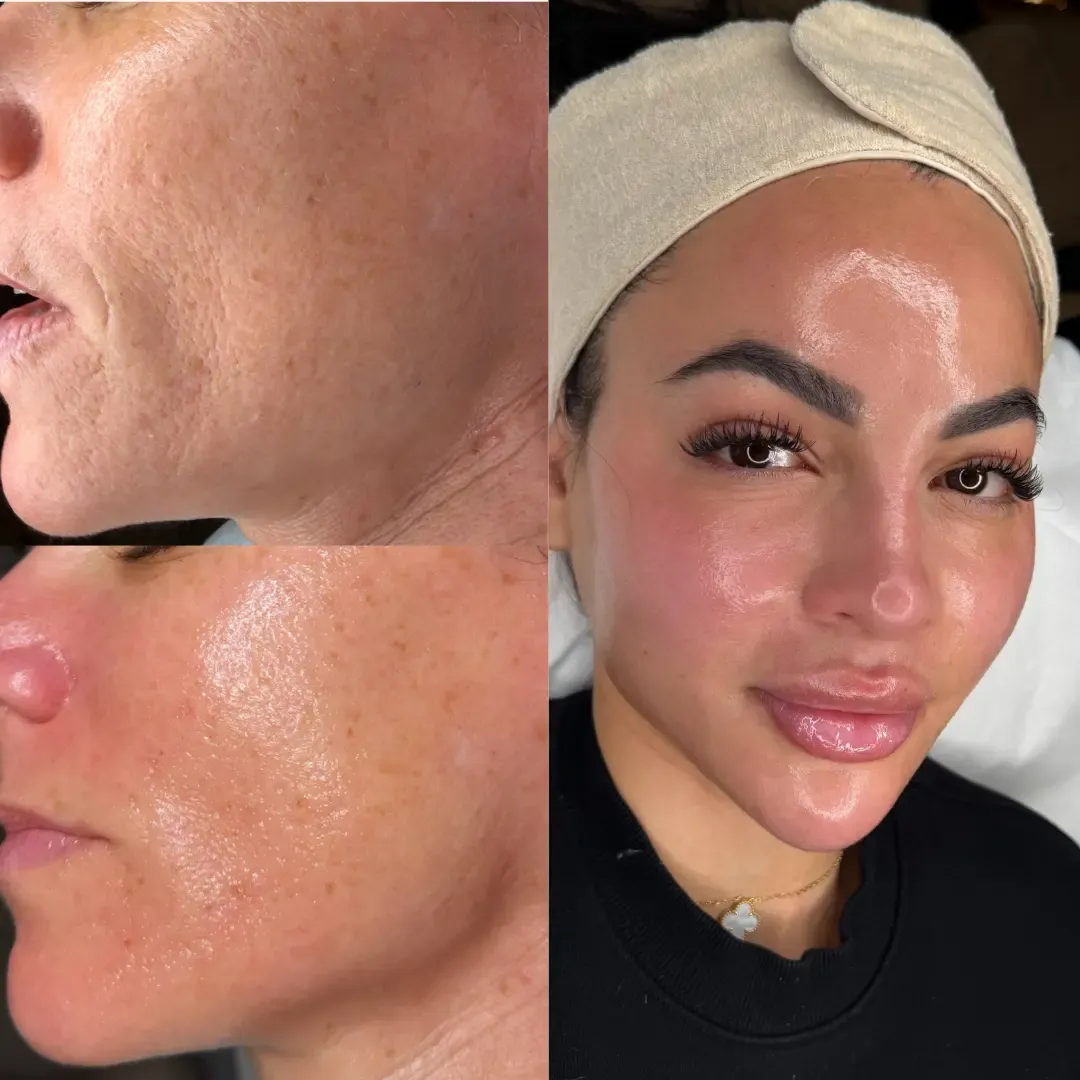 before and after image showing skin before using lumenvy skincare products