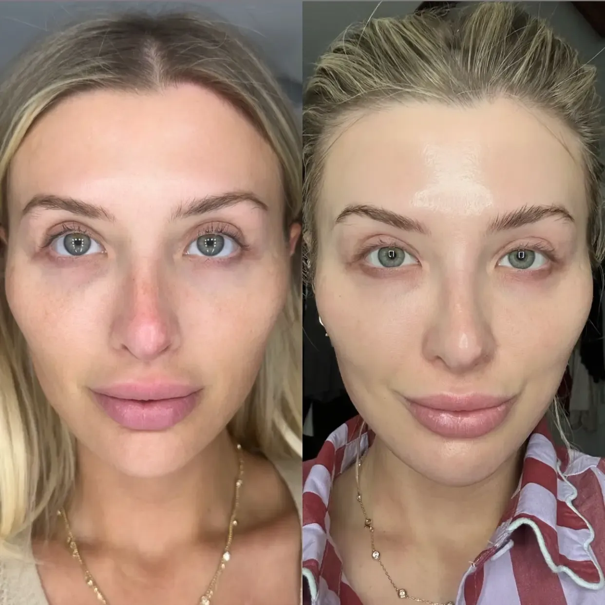 before and after image showing skin before using lumenvy skincare products