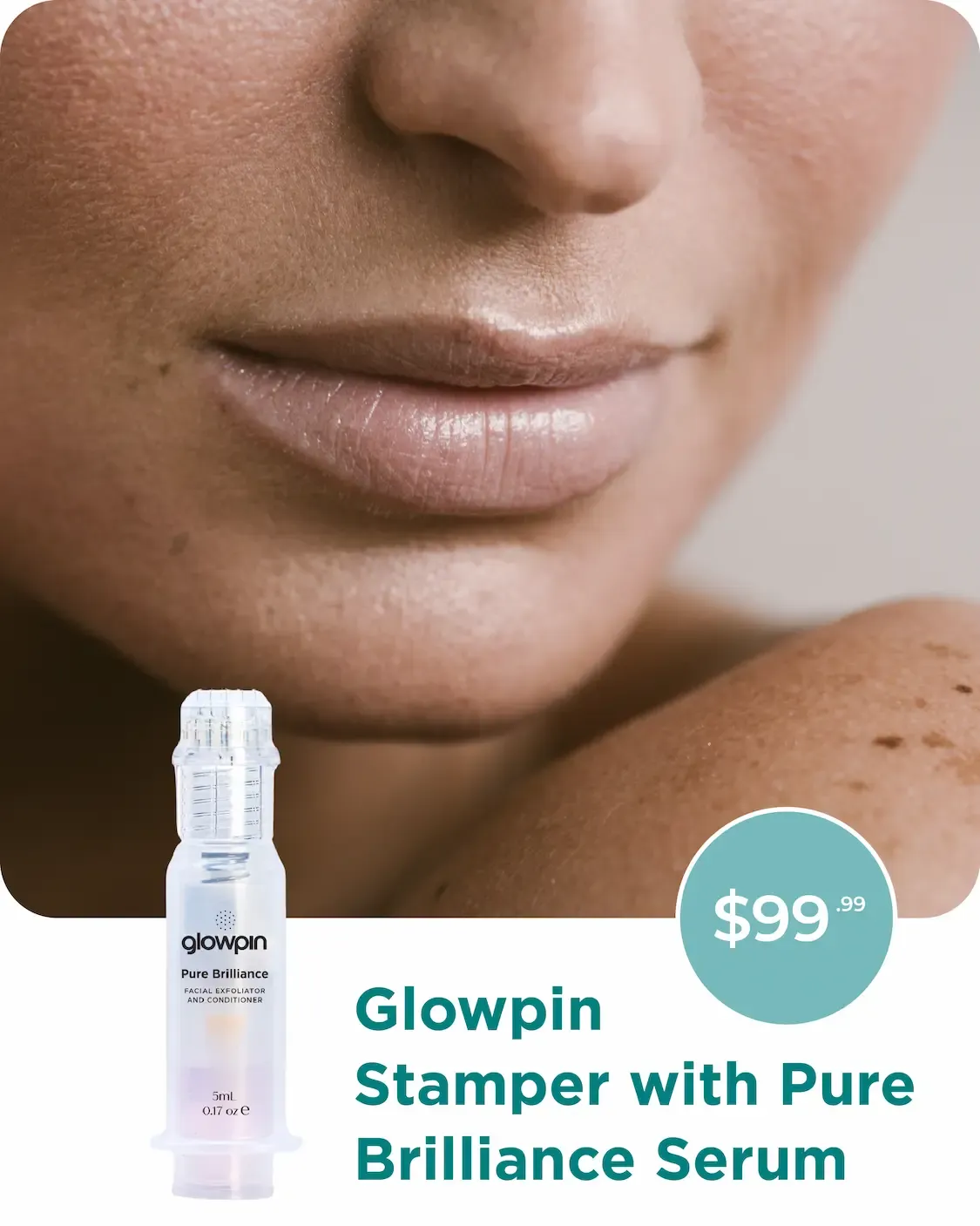 Close-up of a person's mouth and chin, with freckled skin visible on their shoulder in the foreground.