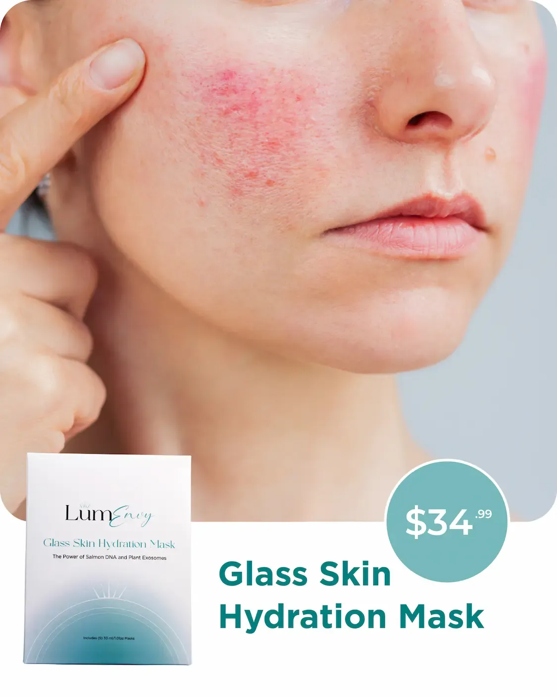 A person pointing to a patch of red, inflamed skin on their cheek.