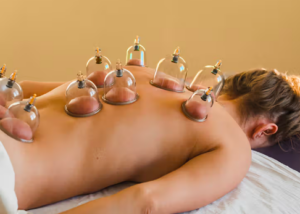 Cupping