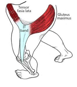Hip Pain