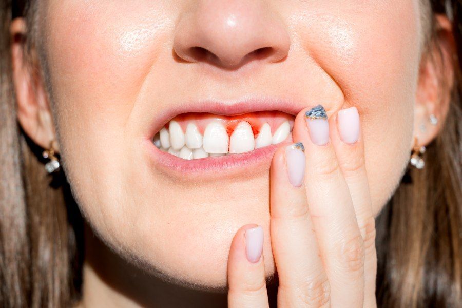 Woman grimacing, holding cheek, showing red, inflamed gums.