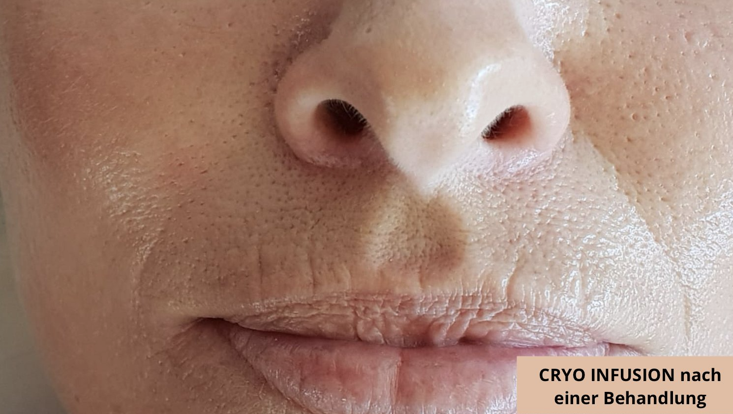 Nahaufnahme einer menschlichen Nase und geschlossener Lippen, mit einer kleinen Beschriftung in der unteren rechten Ecke.