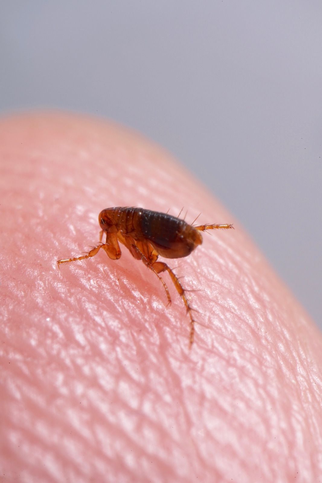 A flea is crawling on a person 's skin.