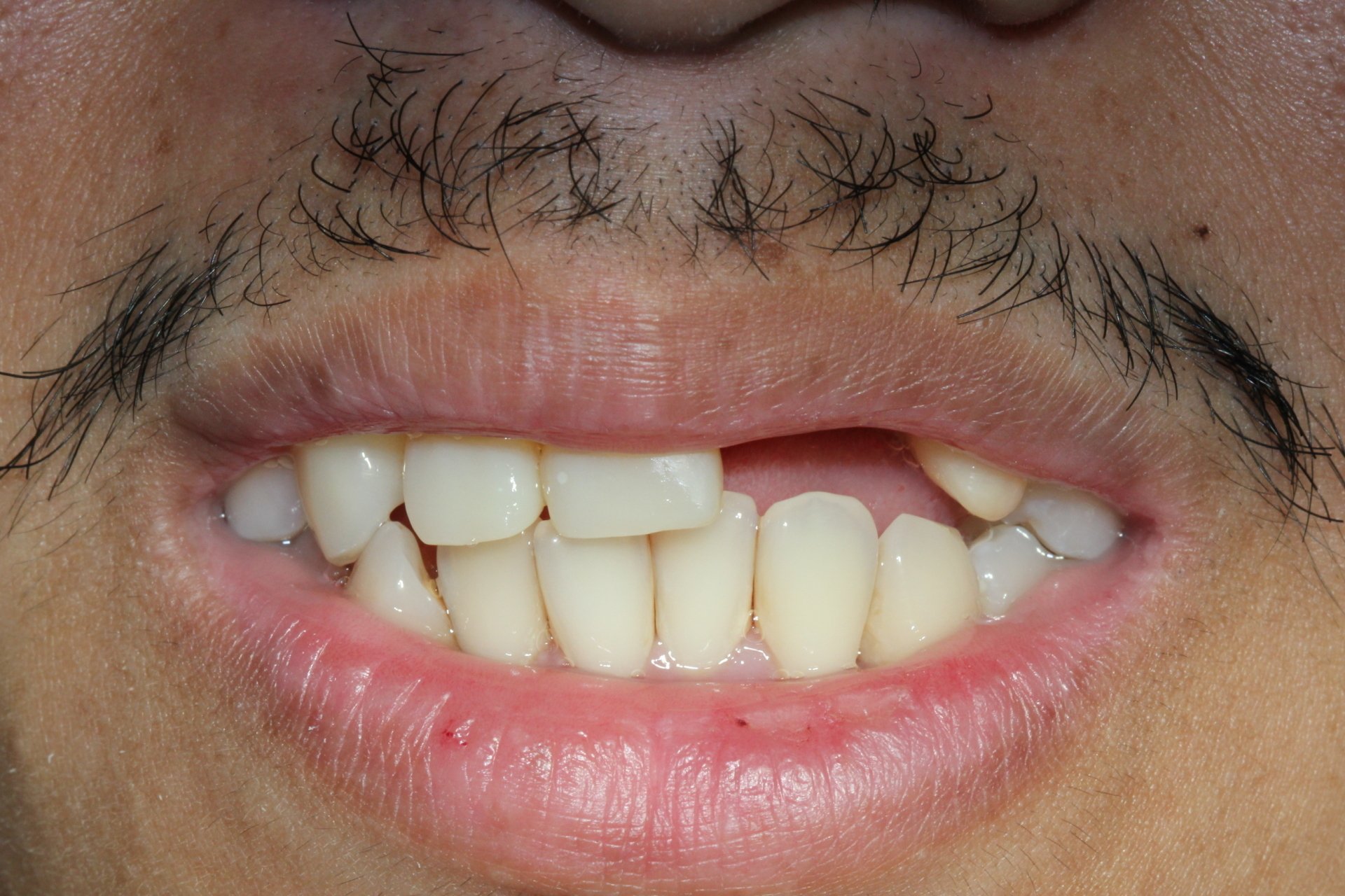 Family Dentist Stockton CA Stockton Dentists DDS California