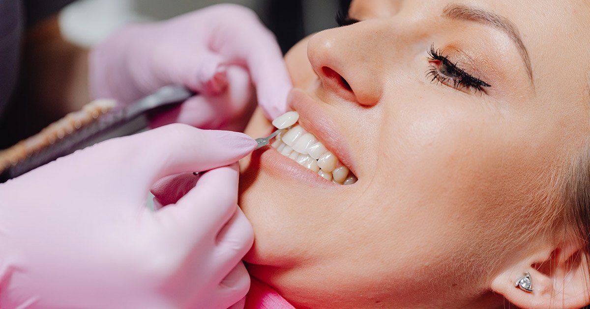 Chipped Tooth, Emergency Dentist Stockton CA