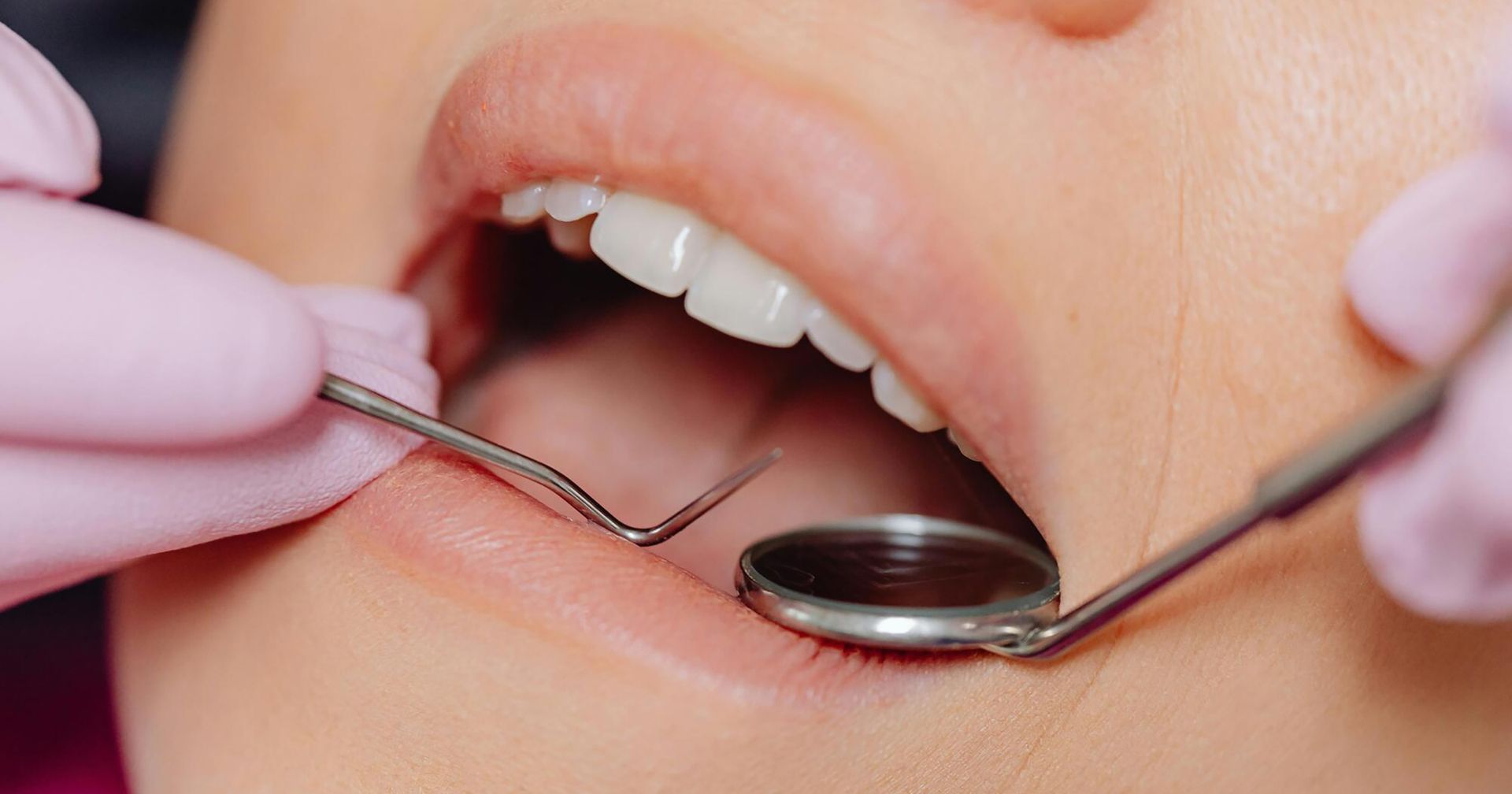 restorative dentistry procedures