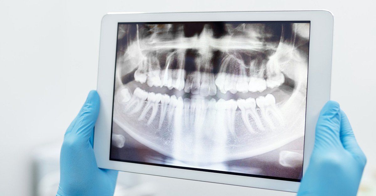 dental x-rays