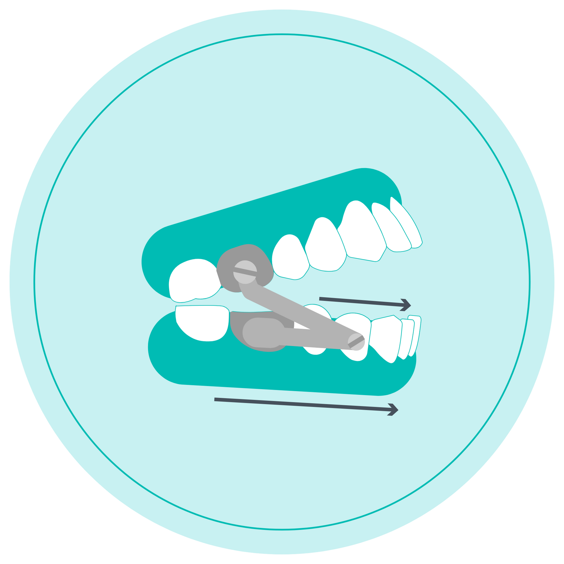 Illustration of a teal jaw with teeth and gray dental tools, showing teeth alignment adjustment