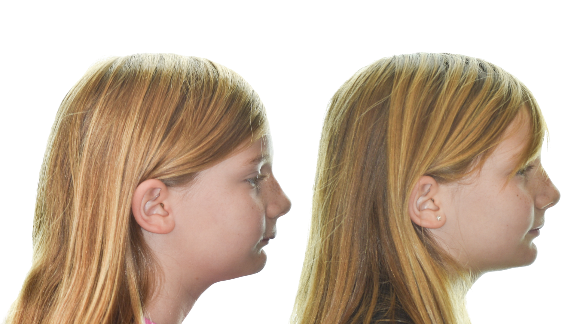 Side-by-side profile views of a blonde girl facing right against a white background
