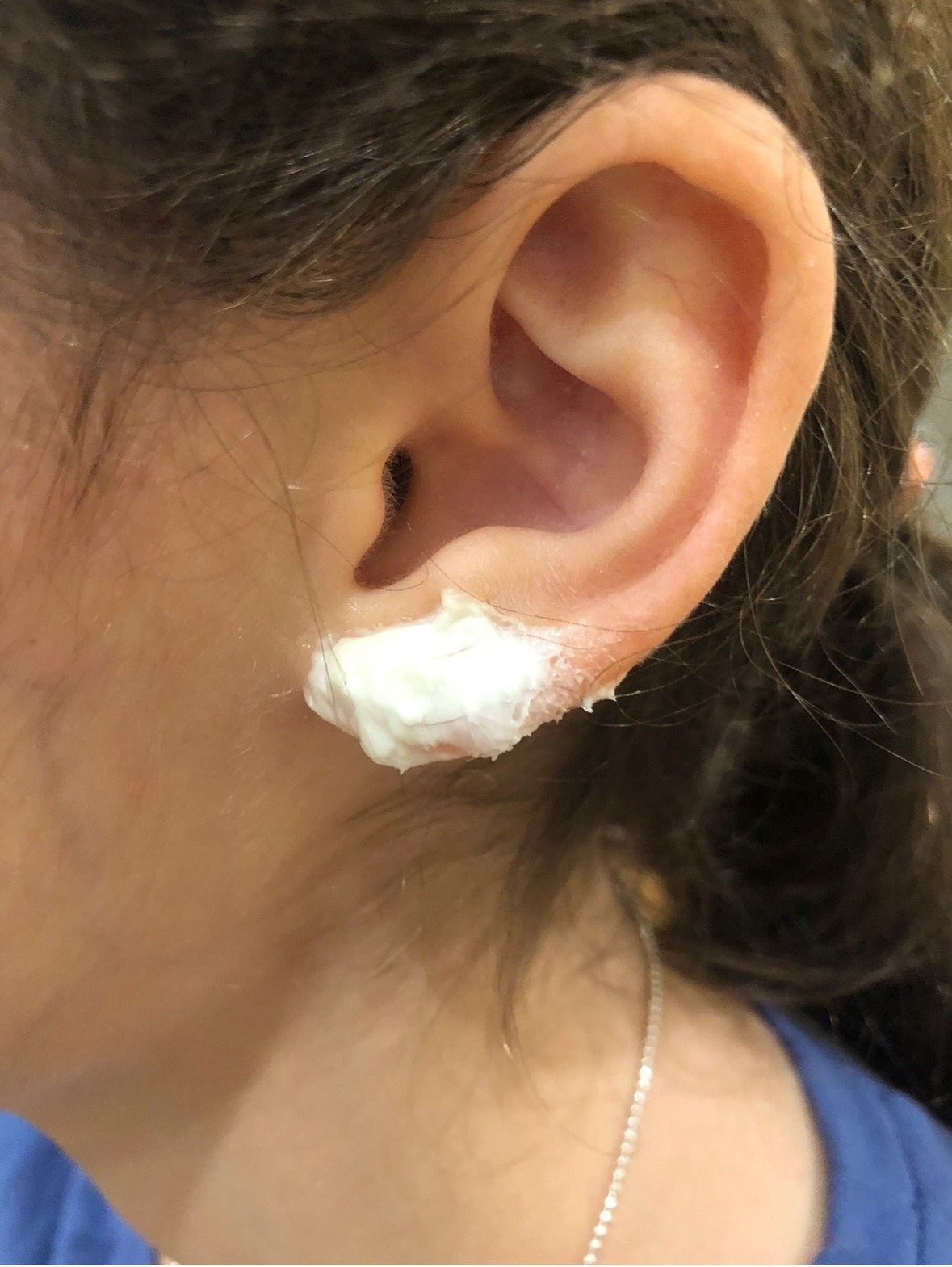 Close-up of an ear with a white cream or ointment applied beneath it