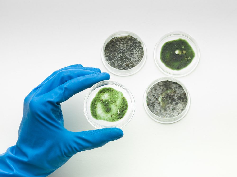 A person wearing a blue glove is holding four petri dishes with different types of bacteria in them.