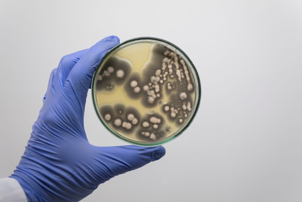 A person is holding a petri dish with bacteria in it.