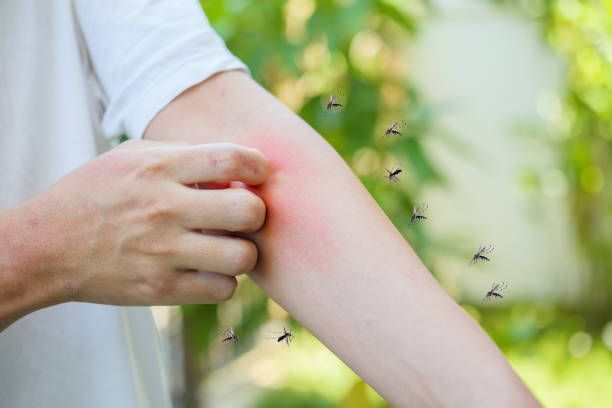 scratching a bite on arm