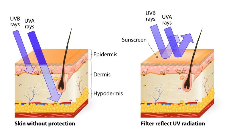 Diagram comparing UV rays on unprotected skin and skin protected by sunscreen, showing UVB/UVA reflection.