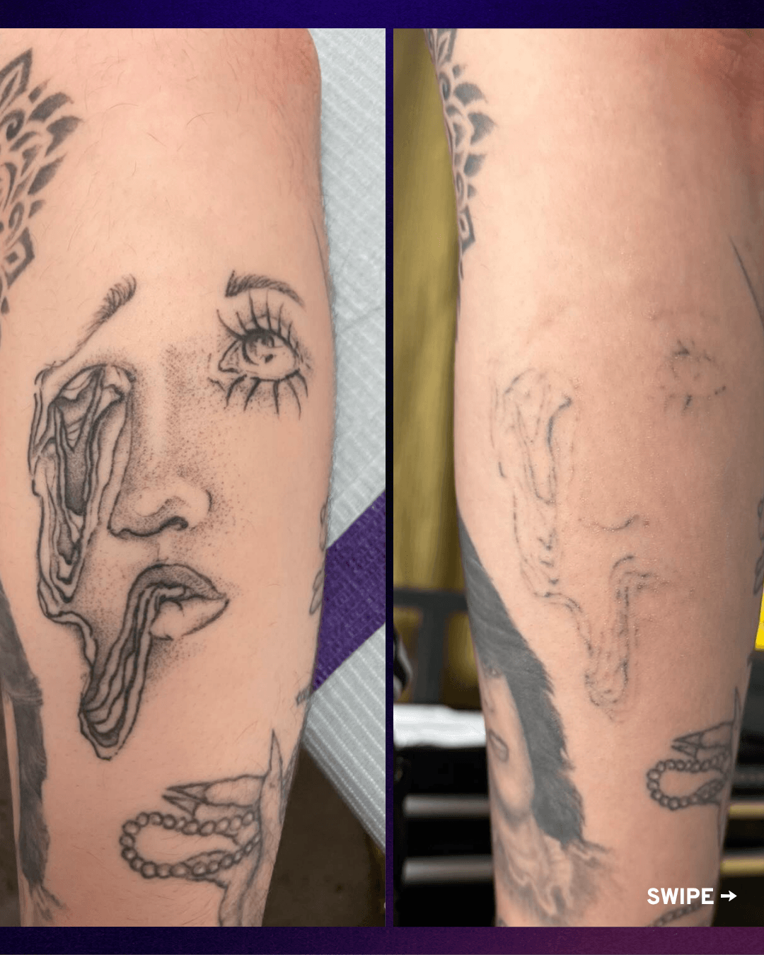 Two side-by-side forearm tattoo progress photos showing a face sketch with a sun and other linework.