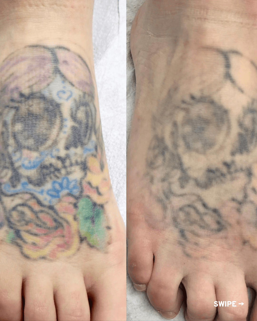 Side-by-side close-up of a tattooed foot, with faded color on the left and a faded black-and-gray version on the right.