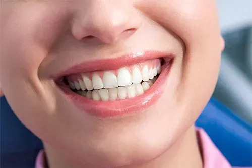 Smiling Woman With Healthy Gums — Columbia, SC — University Dental PA Smiling Woman With Healthy Gums — Columbia, SC — University Dental PA