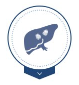 Liver Cancer