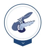 Pancreatic Cancer Surgery