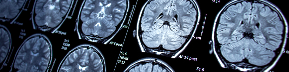 Magnetic Resonance Imaging (MRI) | Bayou Bend Health System